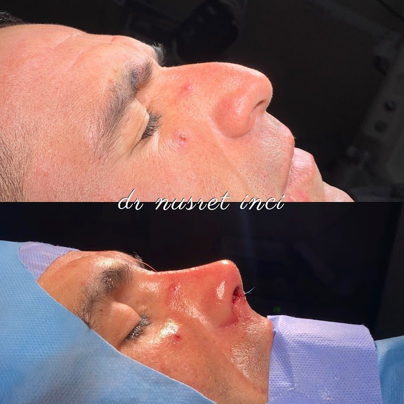 Dr. Nusret İnci - Estetik
