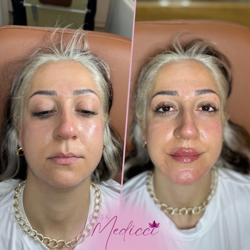 Dr. Rüya Türegün - Estetik