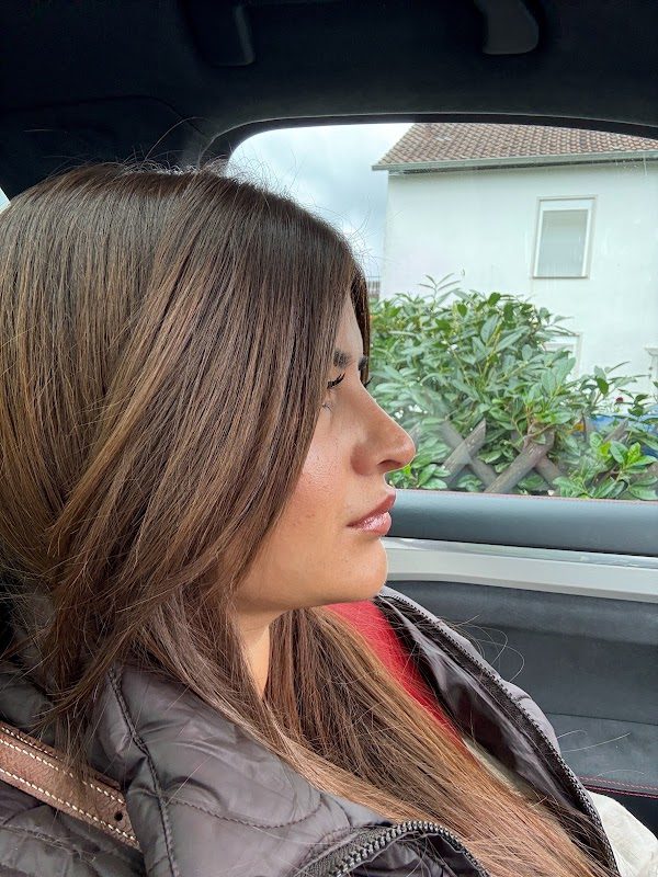 Dr. Ümit Hardal - Estetik
