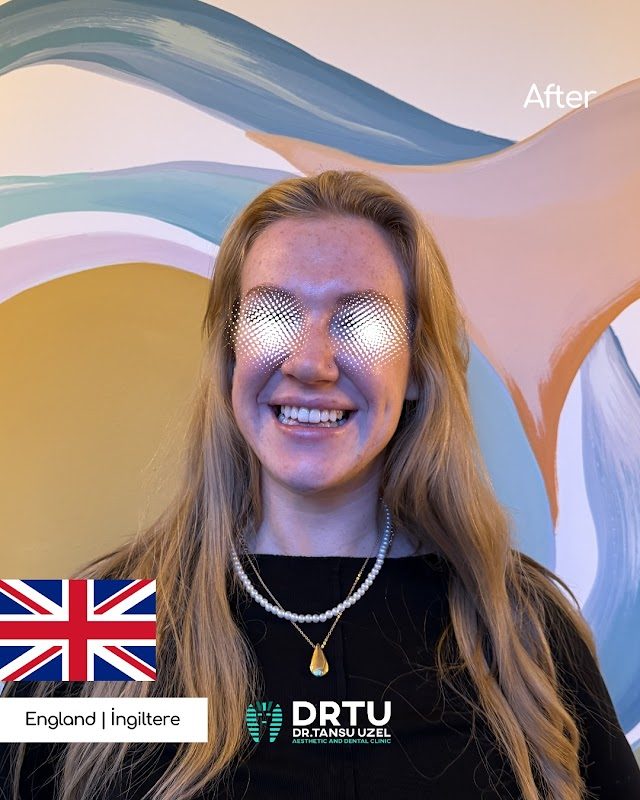 Dr. Tansu Uzel - Estetik