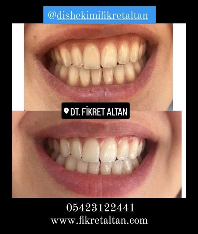 Dt. Fikret Altan - Estetik
